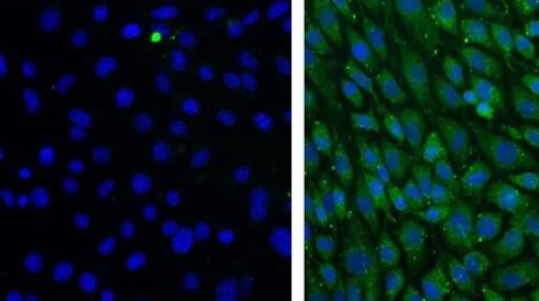 Primary Antibodies for Western Blotting