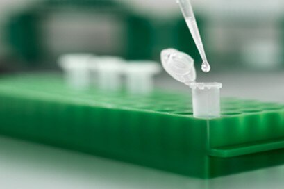 Optimize your IP with ChromoTek Nano-Traps Optimize your IP with ChromoTek Nano-Traps